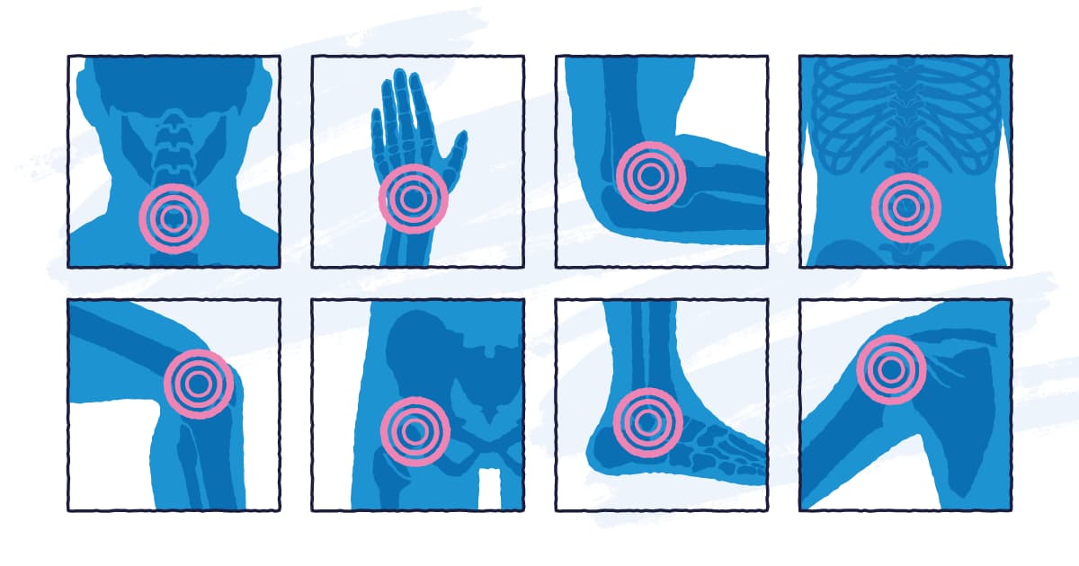 osteoarthritis-blog-article