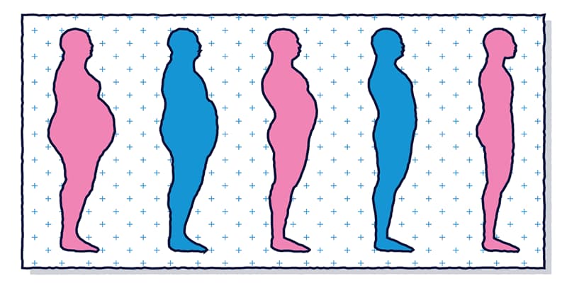 what-is-bariatric-surgery-article