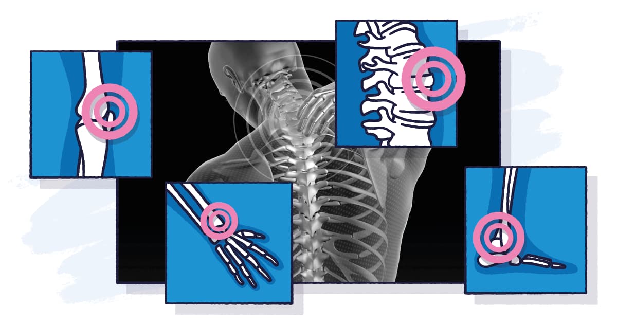 joint-pain-in-the-winter