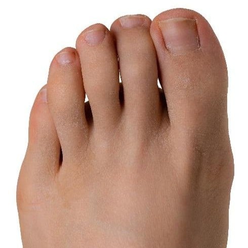After Image