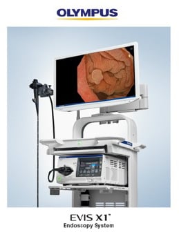 Elevating Standards in Endoscopy at Tees Valley Hospital